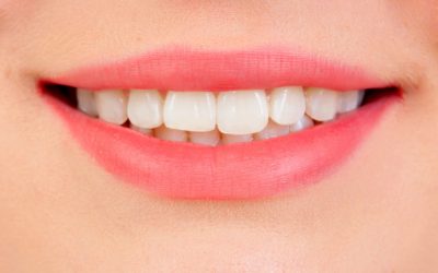 DIY – Dicas para branquear os dentes