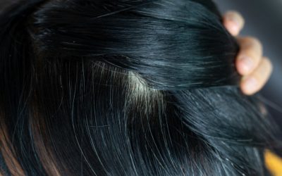 Como deve cuidar do seu couro cabeludo